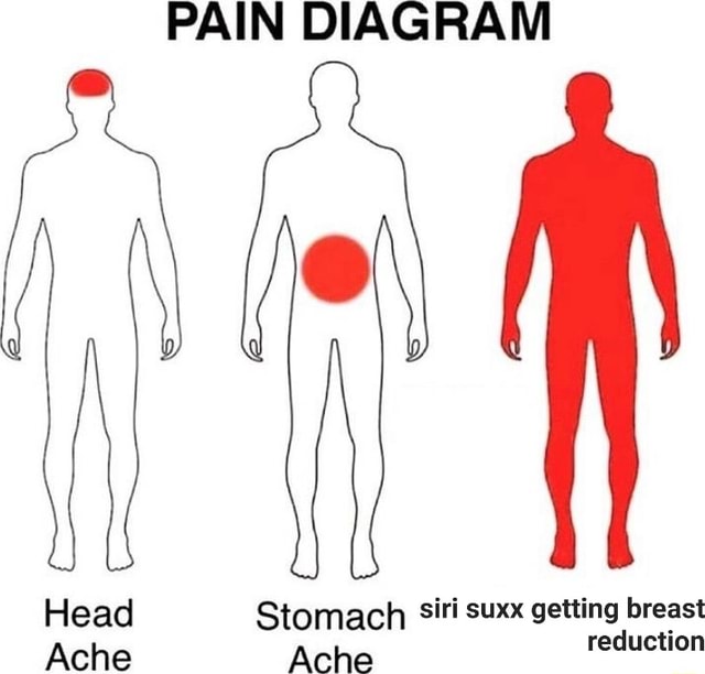 PAIN DIAGRAM Head Stomach Siri Suxx Getting Breast Ache Ache Reduction pain-diagram-head-stomach-siri-suxx-getting-breast-ache-ache-reduction