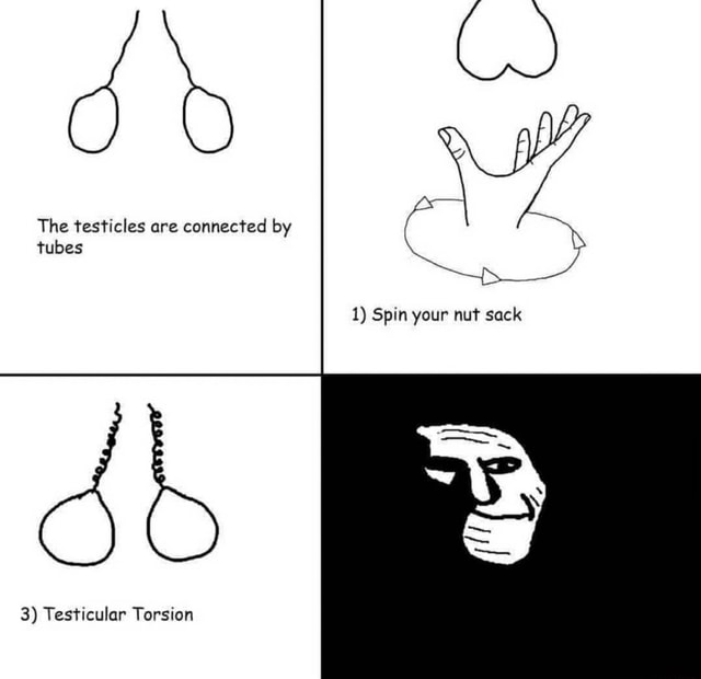 The testicles are connected by tubes db 3) Testicular Torsion 1) Spin