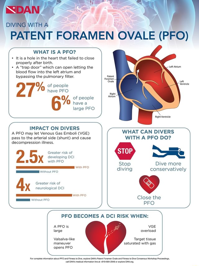 DIMMING WITH As ( WHAT IS A PFO? It is a hole in the heart that failed ...