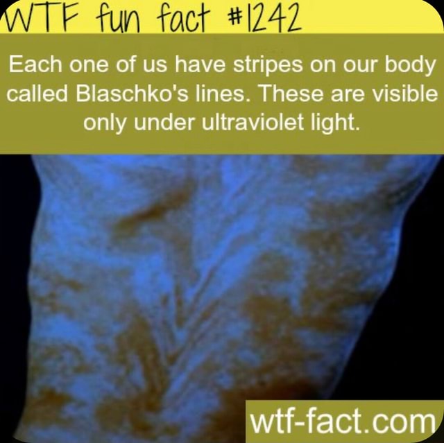 Fun #1242 Each one of us have stripes on our body called Blaschko's ...