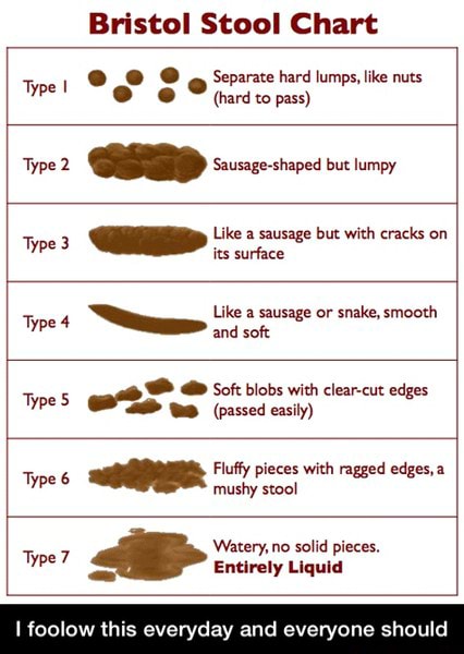 Bristol Stool Chart co TS (hard to pass) Like a sausage or snake ...