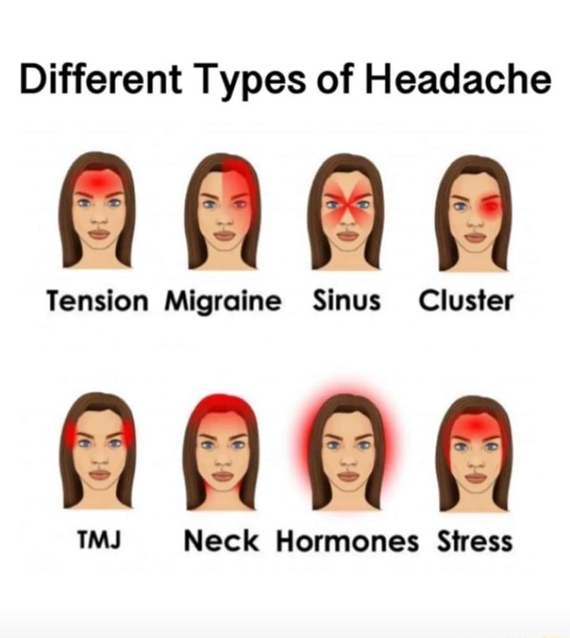 Different Types of Headache AAA Tension Migraine Sinus Cluster Tension ...