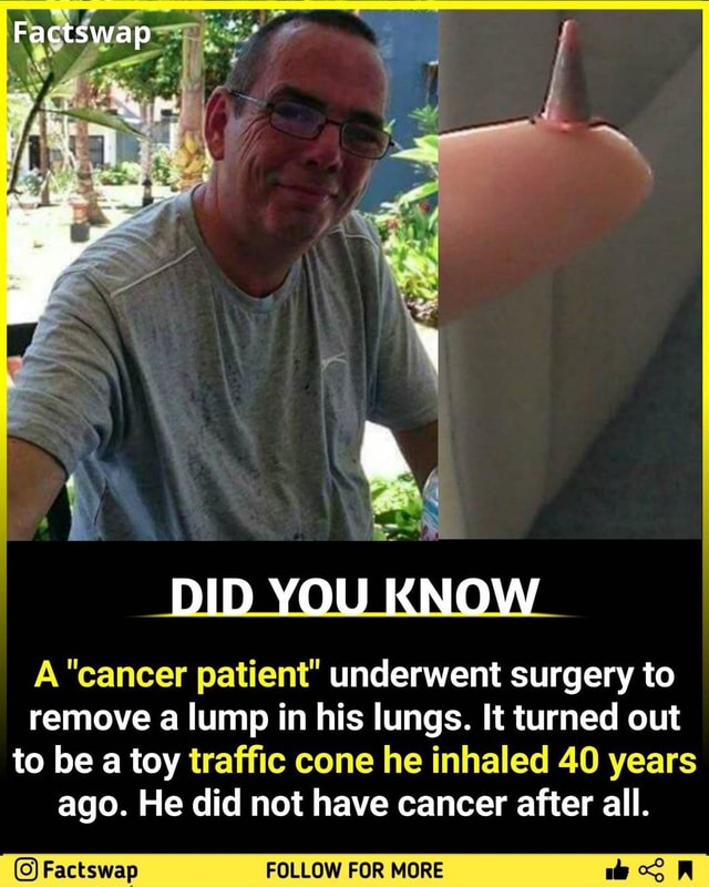 Factswap DID YOU KNOW A "cancer patient" underwent surgery to remove a