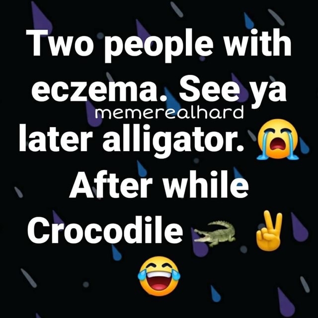 Two People With Eczema See Ya Later Alligator After While Crocodile Ifunny