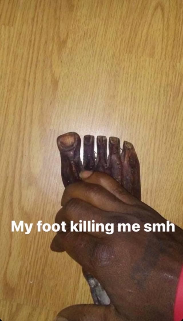 My Foot Killing Me Smh