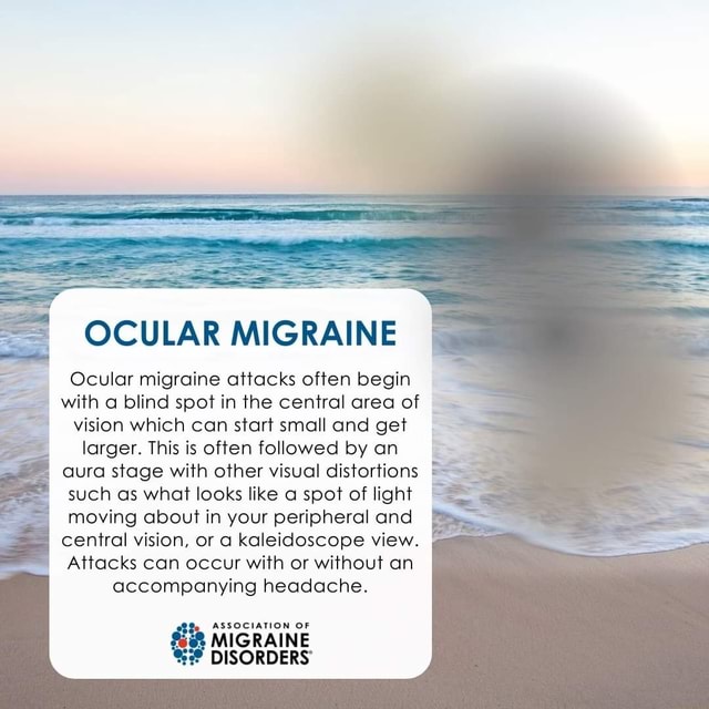 OCULAR MIGRAINE Ocular migraine attacks often begin with a blind spot