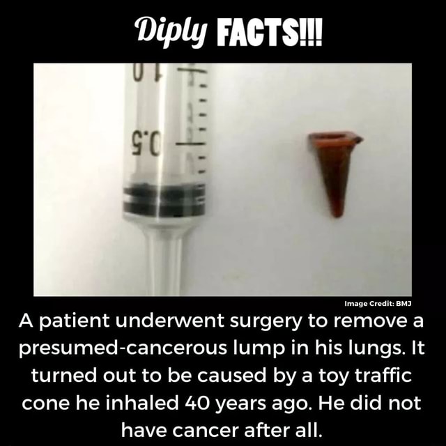 Diply FACTS! Image Credit BMJ A patient underwent surgery to remove a