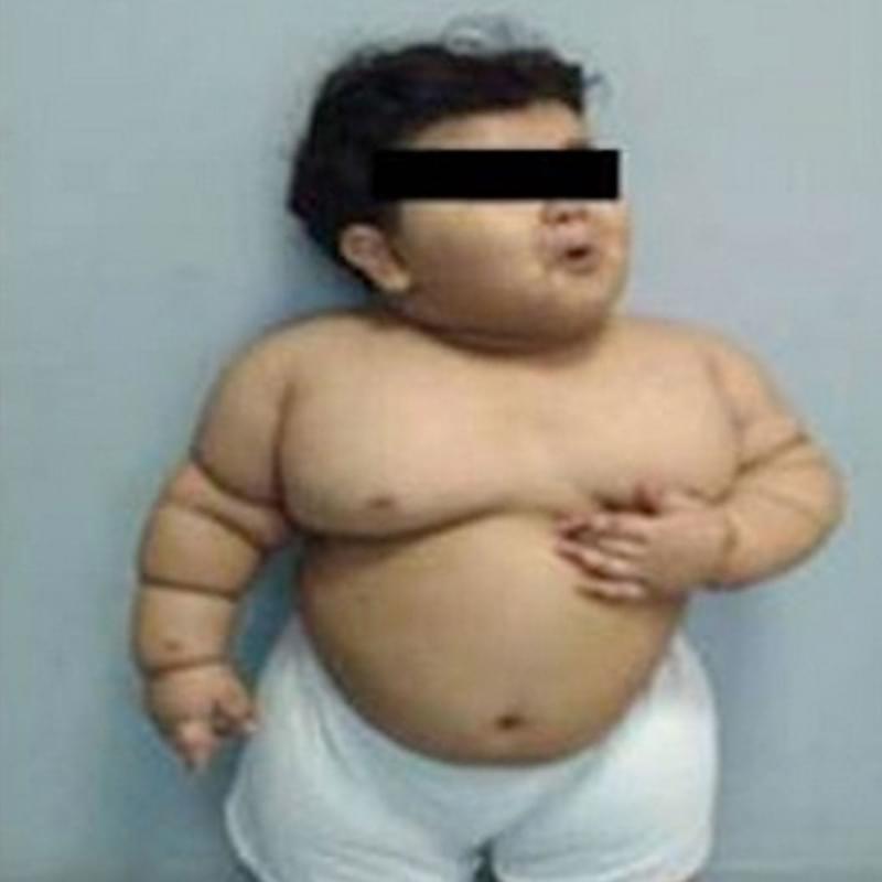 iFunny profile picture for @Obesity
