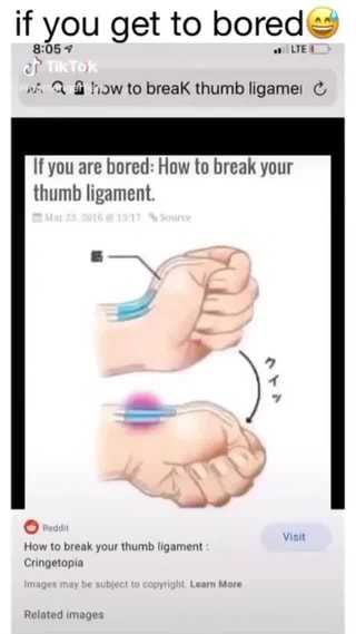 can you break your thumb