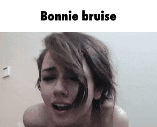 Bonnie Bruise