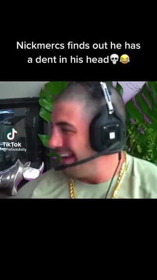 Nickmercs Finds Out He Has A Dent In His Head Wy Ifunny