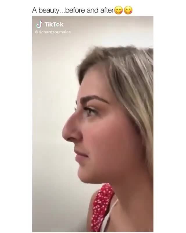 Thegabbieshow Nose