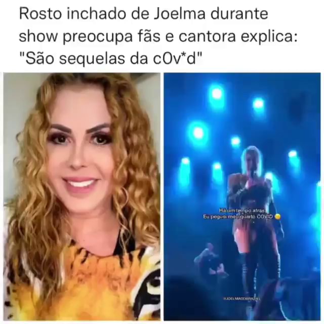 Rosto Inchado De Joelma Durante Show Preocupa Fãs Cantora Explica E