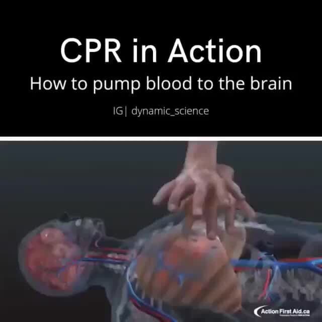 CPR in Action How to pump blood to the brain IGI dynamic_science iFunny