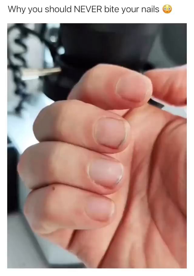 Why you should NEVER bite your nails 