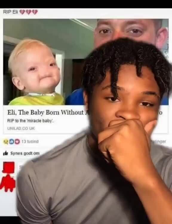 Eli, The Baby Born Without RIP to the 'miracle baby o - iFunny