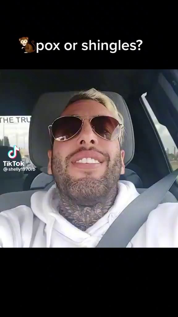 Pox or shingles? TikTok @shell - iFunny