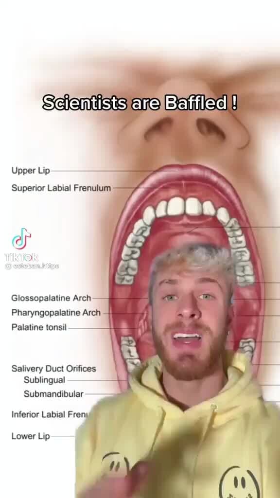 Seientists are Baffled Upper Lip Superior Labial Frenulum